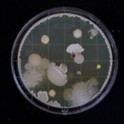 bacteria