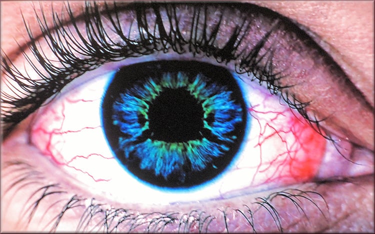 KOS Eye